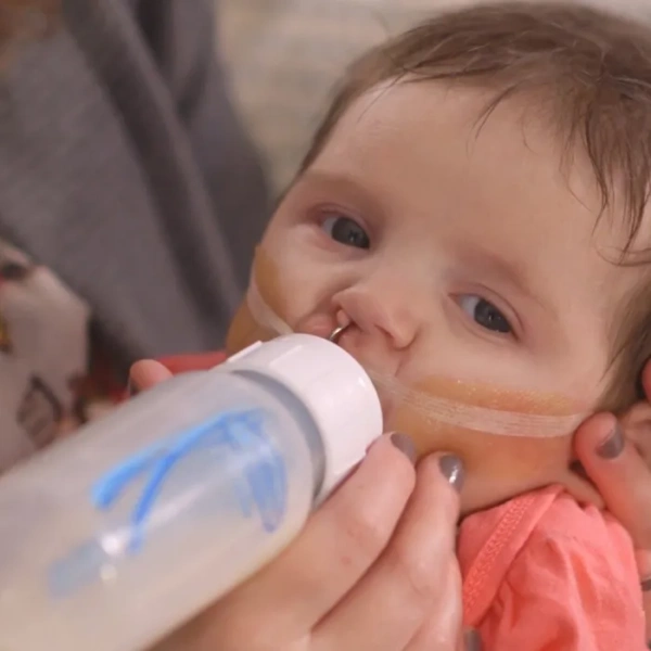 DR BROWN'S Options+ - antykolkowa, wąska butelka standard 120 ml, rozszczep wargi/podniebienia | 0 m+